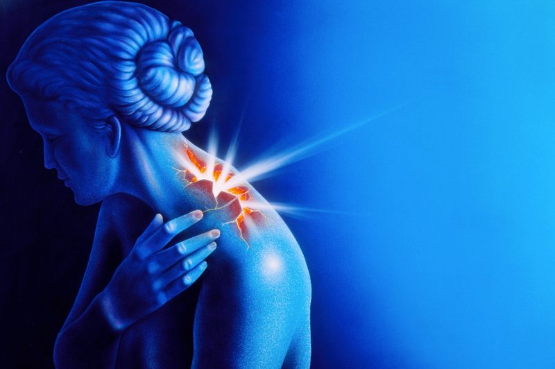 Bolečina v mišicah je lahko pomemben ALARM (foto: profimedia)