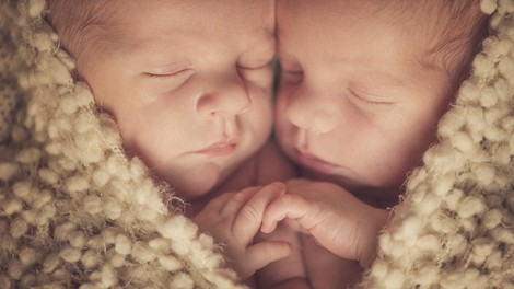 Rodili sta se kot sijamski dvojčici, nato pa so ju z operacijo ločili. Kako izgledata danes?