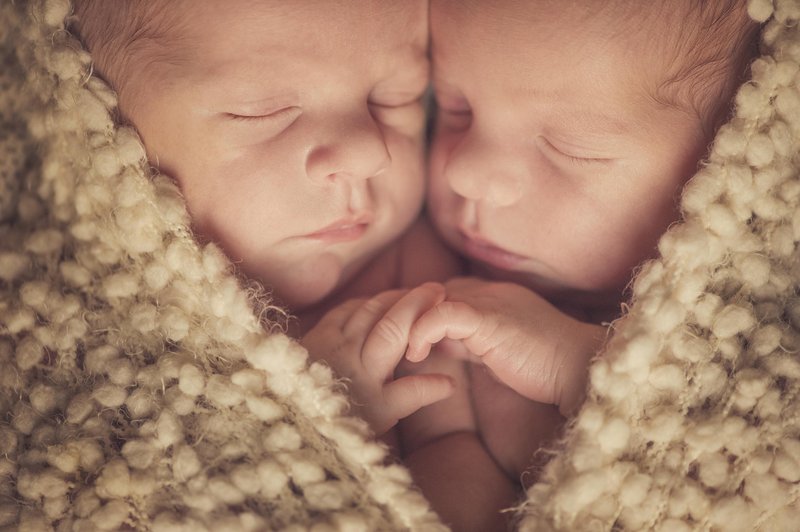 Rodili sta se kot sijamski dvojčici, nato pa so ju z operacijo ločili. Kako izgledata danes? (foto: shutterstock)