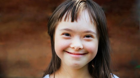 5 lekcij, ki se jih lahko naučimo od otrok z Downovim sindromom