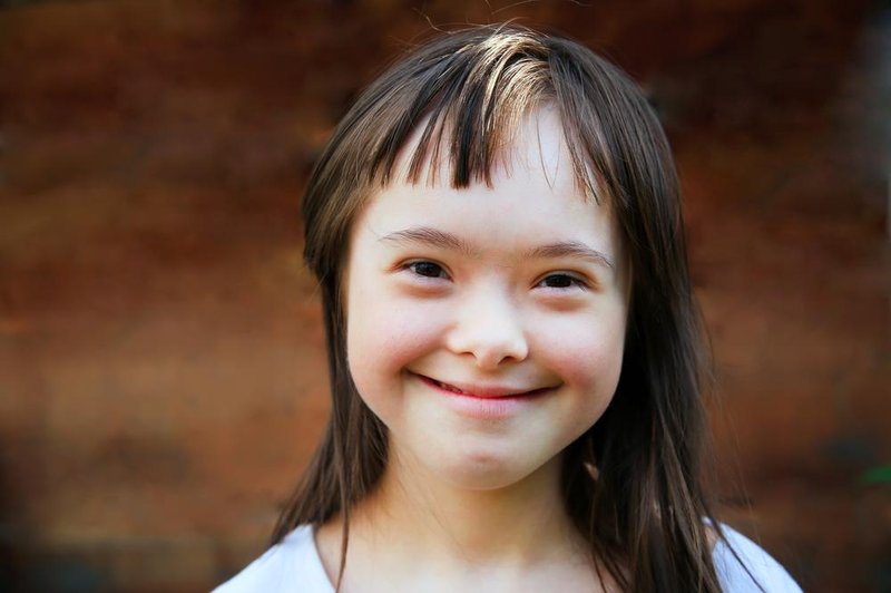 5 lekcij, ki se jih lahko naučimo od otrok z Downovim sindromom (foto: shutterstock)