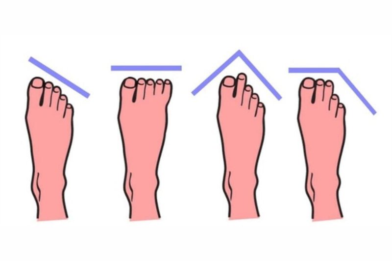 Kaj oblika stopal pove o vašem življenju? (foto: Espreso.co.rs/printscreen)